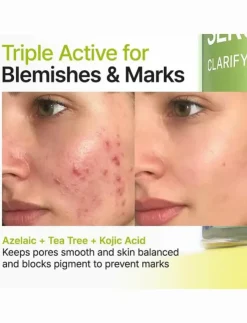Kvinnor Purito Hudvård|Azelaic Acid 10 Kojic Tea Tree Serum - Serum